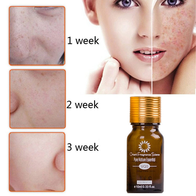 Dredge Meridian Skin Care Natural Pure Removal Acné Vergetures Élimination des cicatrices Huile essentielle