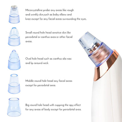 Instrument de nettoyage des pores pour points noirs, appareil électrique pour éliminer l'acné et les points noirs