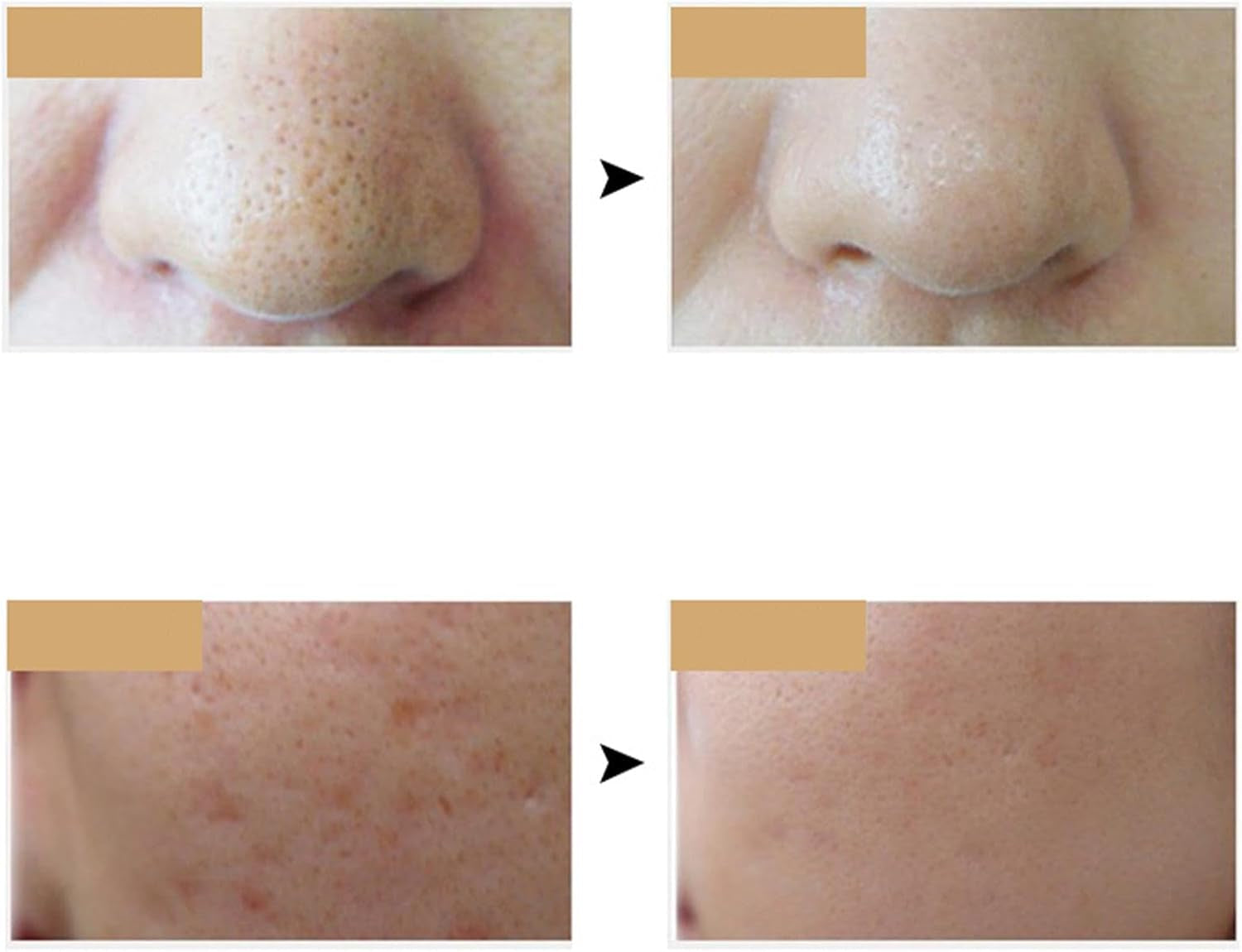 Masque LED Pour Le Visage,Soins De La Peau Avec Masque LED - Masque De Soin De La Peau Du Visage À Lumière LED 7 Couleurs - Masque De Beauté LED Rechargeable Pour Usage Domestique, Out De